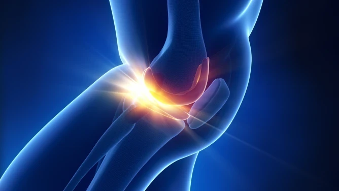 Alternatives to Arthroscopic Knee Surgery for a Torn Meniscus