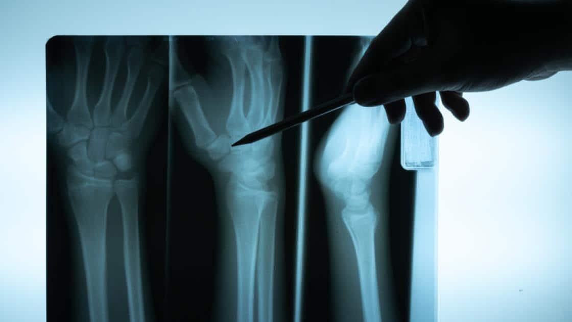orthopedic surgeons in Chicago