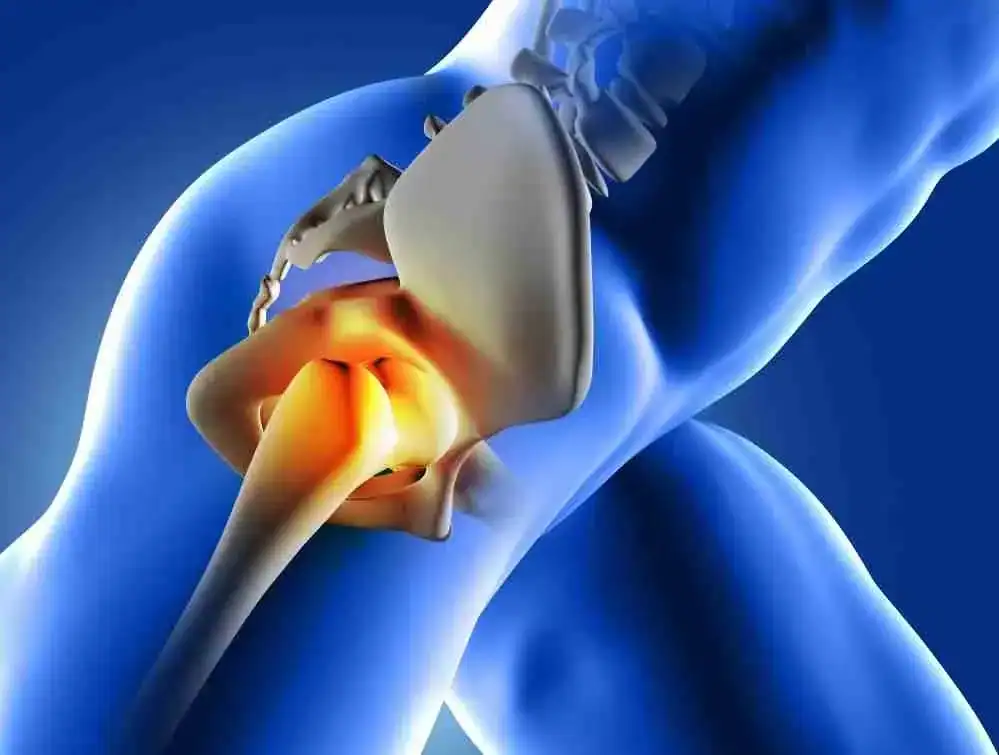 stem cell therapy for hips 2